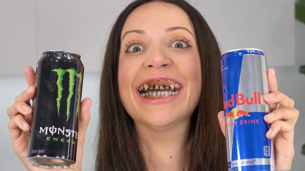 Drinking Red Bull Too Much Damage Your Teeth?